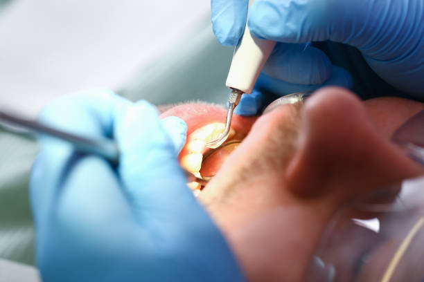Best Knocked-Out Tooth Emergency  in Mineral Ridge, OH